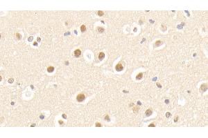 Detection of APPBP1 in Human Cerebrum Tissue using Polyclonal Antibody to Amyloid Beta Precursor Protein Binding Protein 1 (APPBP1) (Amyloid beta Precursor Protein Binding Protein 1 (AA 229-534) antibody)