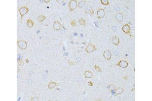 Immunohistochemistry of paraffin-embedded Rat brain using CD63 Polyclonal Antibody at dilution of 1:100 (40x lens). (CD63 antibody)