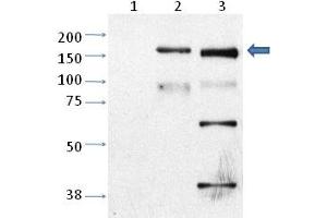 Western blot analysis of Trpm2 in CHO cells untransfected (Lane 1), CHO cell transfected with rat TRPM2 (Lane 2) and mouse cortical neurons (cultured) (Lane 3) with Trpm2 polyclonal antibody . (TRPM2 antibody  (AA 1430-1508))