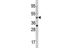 Western blot analysis of AADAC antibody and 293 lysate.