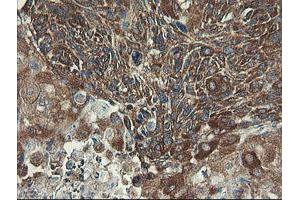 Image no. 1 for anti-Ubiquitin-Conjugating Enzyme E2, J1, U (UBE2J1) antibody (ABIN1501638) (UBE2J1 antibody)
