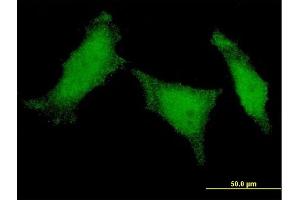 Immunofluorescence of monoclonal antibody to MED8 on HeLa cell. (MED8 antibody  (AA 1-59))