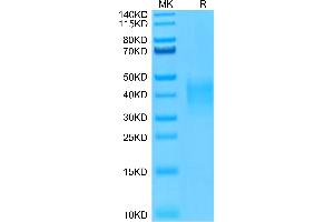 Human TRAIL R4 on Tris-Bis PAGE under reduced conditions. (DcR2 Protein (His-Avi Tag))