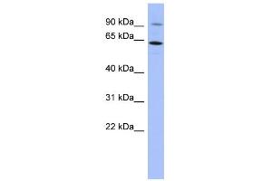 WB Suggested Anti-ZNF778 Antibody Titration:  0. (ZNF778 antibody  (N-Term))