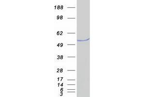 Western Blotting (WB) image for Friend Leukemia Virus Integration 1 (FLI1) protein (Myc-DYKDDDDK Tag) (ABIN2721225)