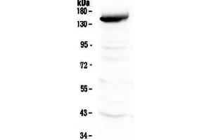 Western blot analysis of VEGF Receptor 3 using anti-VEGF Receptor 3 antibody . (FLT4 antibody  (AA 25-259))