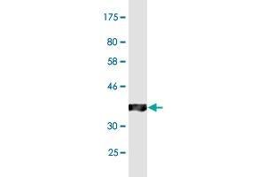 ABCC2 antibody  (AA 214-313)