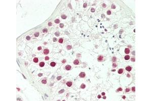 Formalin-fixed and paraffin-embedded H. (Aurora Kinase C antibody  (N-Term))