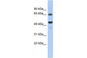Western Blotting (WB) image for anti-Aldehyde Dehydrogenase 7 Family, Member A1 (ALDH7A1) antibody (ABIN2463934) (ALDH7A1 antibody)