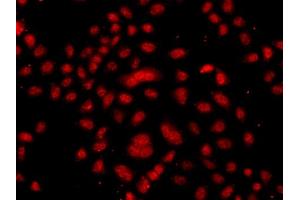 Immunofluorescence analysis of  cells using FBXW11 antibody (ABIN6133150, ABIN6140529, ABIN6140530 and ABIN6223739). (FBXW11 antibody  (AA 1-140))