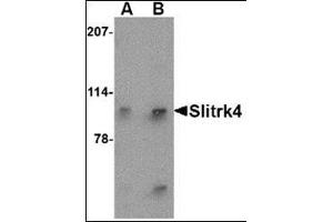 Western blot analysis of Slitrk4 in mouse brain tissue lysate with this product at (A) 0. (SLITRK4 antibody  (N-Term))