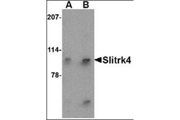 SLITRK4 anticorps  (N-Term)