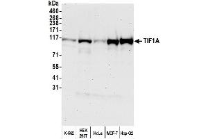 Western Blotting (WB) image for anti-Tripartite Motif Containing 24 (TRIM24) (AA 700-750) antibody (ABIN7454678) (TRIM24 antibody  (AA 700-750))