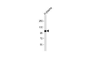 Anti-CFB Antibody (Center) at 1:1000 dilution + human plasma lysate Lysates/proteins at 20 μg per lane. (Complement Factor B antibody  (AA 469-494))