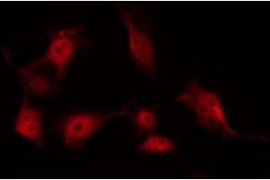 ABIN6269264 staining COS7 by IF/ICC. (Crk antibody)