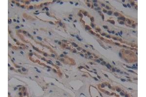 Immunohistochemistry (IHC) image for anti-Nucleoporin 155kDa (NUP155) (AA 1154-1379) antibody (ABIN7444085)