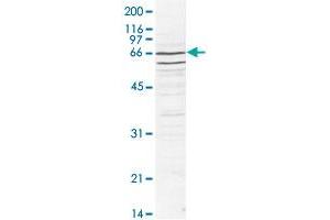 Western blot was performed using nuclear extracts from HeLa cells (HeLa NE, 20 ug) and the CDC73 polyclonal antibody  at dilution 1 : 1,000 in TBS-Tween + 5% skimmed milk. (HRPT2 antibody)