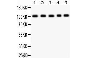 Anti- Band 3 Picoband antibody, Western blotting All lanes: Anti Band 3  at 0. (Band 3/AE1 antibody  (AA 28-365))