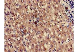 Immunohistochemistry of paraffin-embedded human liver tissue using ABIN7163511 at dilution of 1:100 (KLKB1 antibody  (AA 503-612))