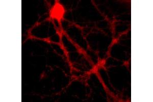 Immunocytochemistry on cultured hippocampus neurons (dilution 1 : 500). (SNAP alpha/beta antibody)