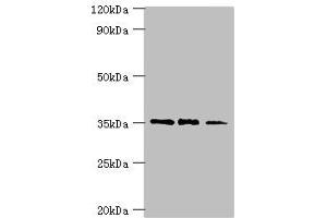 Western blot All lanes: FOSL2 antibody at 8 μg/mL Lane 1: MCF-7 whole cell lysate Lane 2: Jurkat whole cell lysate Lane 3: PC-3 whole cell lysate Secondary Goat polyclonal to rabbit IgG at 1/10000 dilution Predicted band size: 36, 35, 32 kDa Observed band size: 36 kDa (FOSL2 antibody  (AA 187-326))