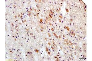 Formalin-fixed and paraffin embedded rat brain tissue labeled with Anti-Tau protein Polyclonal Antibody , Unconjugated at 1:200, followed by conjugation to the secondary antibody and DAB staining (tau antibody  (AA 683-758))