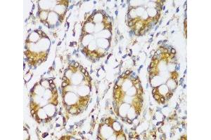 Immunohistochemistry of paraffin-embedded Human colon using ERLIN1 Polyclonal Antibody at dilution of 1:100 (40x lens). (ERLIN1 antibody)