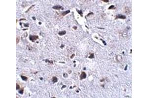 Immunohistochemistry (IHC) image for anti-Regulator of Calcineurin 2 (RCAN2) (Middle Region) antibody (ABIN1031056) (RCAN2 antibody  (Middle Region))