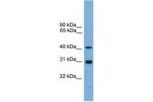 Image no. 1 for anti-Chromosome 1 Open Reading Frame 51 (C1orf51) (AA 143-192) antibody (ABIN6744999) (C1orf51 antibody  (AA 143-192))