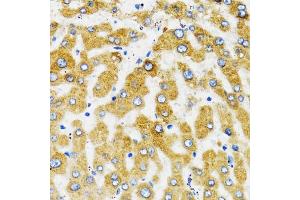 Immunohistochemistry of paraffin-embedded human liver using SLC27A2 antibody (ABIN1874822) at dilution of 1:100 (40x lens). (SLC27A2 antibody)