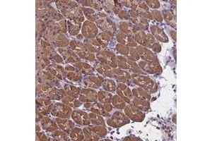 Immunohistochemical staining of human stomach with SYCE2 polyclonal antibody  shows moderate cytoplasmic positivity in glandular cells.