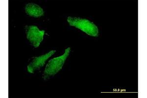 Immunofluorescence of purified MaxPab antibody to STK11 on HeLa cell. (LKB1 antibody  (AA 1-433))