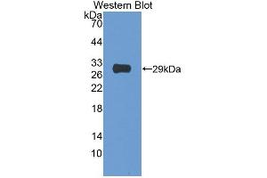 Figure. (NAIP antibody  (AA 923-1148))