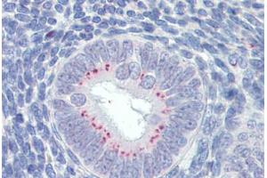 Uterus, Human: Formalin-Fixed, Paraffin-Embedded (FFPE) (SFRP1 antibody  (AA 171-183))