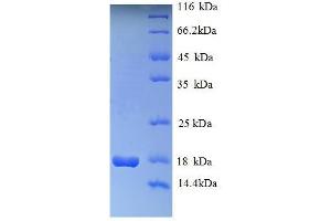 HIST1H2AG Protein (AA 2-130) (His tag)