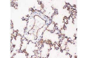 IHC-P testing of rat lung tissue (Angiotensin I Converting Enzyme 1 antibody  (AA 651-864))
