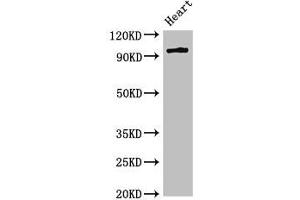 Western Blot Positive WB detected in: Rat heart tissue All lanes: PRKD3 antibody at 3 μg/mL Secondary Goat polyclonal to rabbit IgG at 1/50000 dilution Predicted band size: 101, 69 kDa Observed band size: 101 kDa (PRKD3 antibody  (AA 326-510))