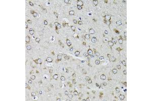 Immunohistochemistry of paraffin-embedded mouse brain using RPS10 antibody (ABIN1980247) at dilution of 1:100 (40x lens). (RPS10 antibody)