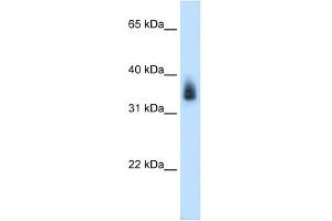 MAGEA8 antibody used at 0. (MAGEA8 antibody  (N-Term))