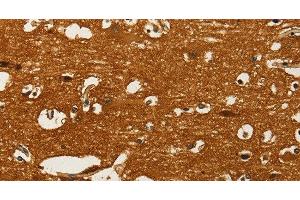 Immunohistochemistry of paraffin-embedded Human brain using GOT1 Polyclonal Antibody at dilution of 1:50 (GOT1 antibody)