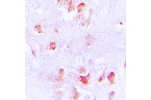Immunohistochemical analysis of Creatine Kinase M staining in human brain formalin fixed paraffin embedded tissue section. (CKM antibody  (N-Term))