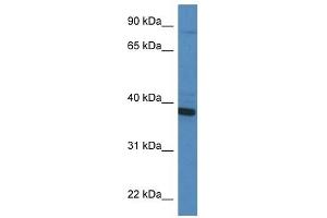 Western Blot showing CYB5R3 antibody used at a concentration of 1 ug/ml against HT1080 Cell Lysate (CYB5R3 antibody  (C-Term))