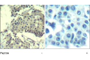 Image no. 1 for anti-Mechanistic Target of Rapamycin (serine/threonine Kinase) (mTOR) (Ser2481) antibody (ABIN401642) (MTOR antibody  (Ser2481))