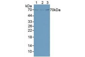 Figure. (FOXO1 antibody  (AA 222-469))