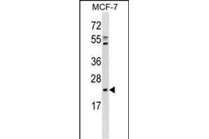 EBP Antibody (C-term) (ABIN1881278 and ABIN2838706) western blot analysis in MCF-7 cell line lysates (35 μg/lane). (EBP antibody  (C-Term))