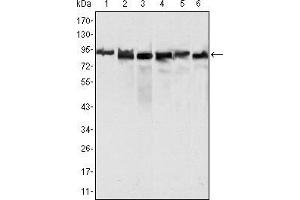 Western blot analysis using MLH1 mouse mAb against Hela (1), MCF-7 (2) and A549 (3), Jurkat (4), 2R75 (5) and COS (6) cell lysate. (MLH1 antibody  (AA 381-483))