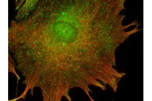 Immunocytochemistry (ICC) image for anti-CAP-GLY Domain Containing Linker Protein 1 (CLIP1) (AA 1283-1438) antibody (ABIN1742486) (CLIP1 antibody  (AA 1283-1438))