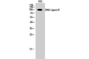 Western Blotting (WB) image for anti-Ligase IV, DNA, ATP-Dependent (LIG4) (Internal Region) antibody (ABIN3184324) (LIG4 antibody  (Internal Region))