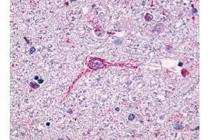Immunohistochemical staining of Brain (Neurons and glia) using anti- NTSR1 antibody ABIN122340 (NTSR1 antibody  (N-Term))