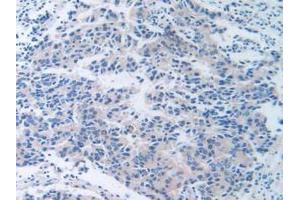 Figure. (TTR antibody  (AA 21-147))